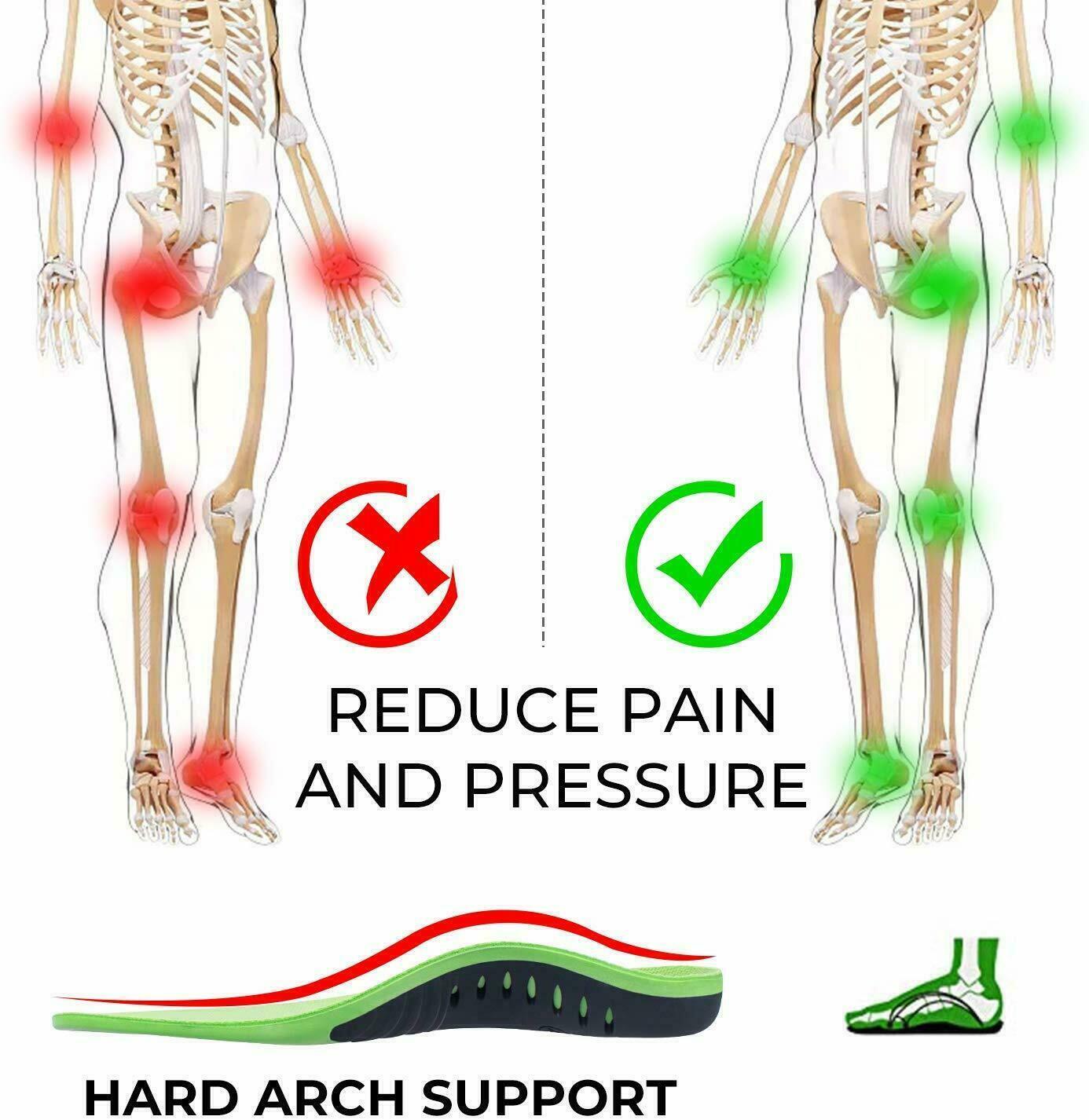 Plantar Fasciitis Insoles | Arch Support | ActiveSupport UK